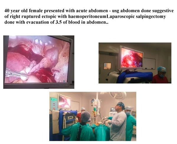 Case Study