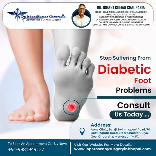 Diabetic Foot Ulcer Surgery